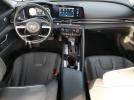 Hyundai ELANTRA Limited Image 5
