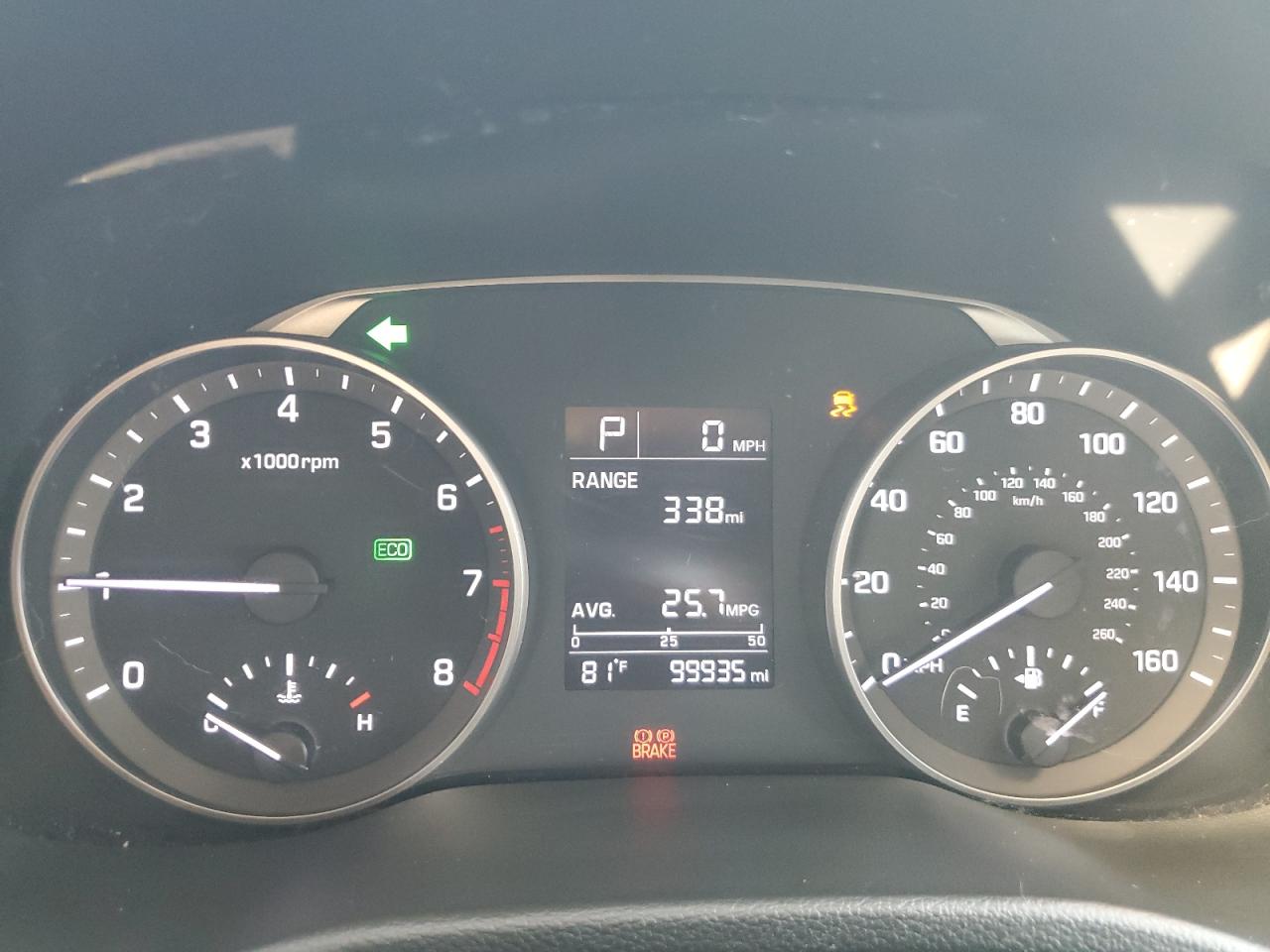 Hyundai ELANTRA Se Image 4